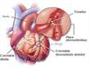 Doença cardiovascular o que é