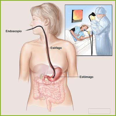 O que é Endoscopia