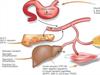 Síndrome metabólica - doenças cardiovasculares e diabetes mellitus